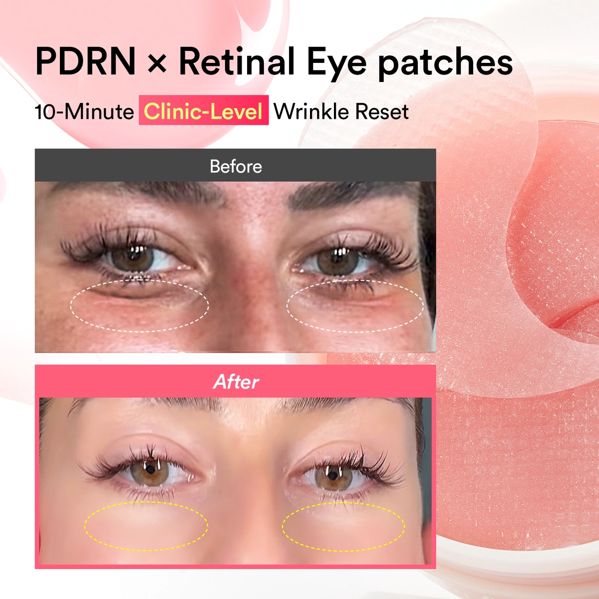 Pdrn X Retinal X Collagen Eye Patches For Wrinkle Repair Anti Aging Care by Abib