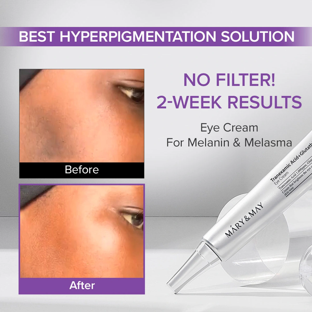 Amazon Hot Selling Dark Circle Brightening Eye Cream by Mary & May